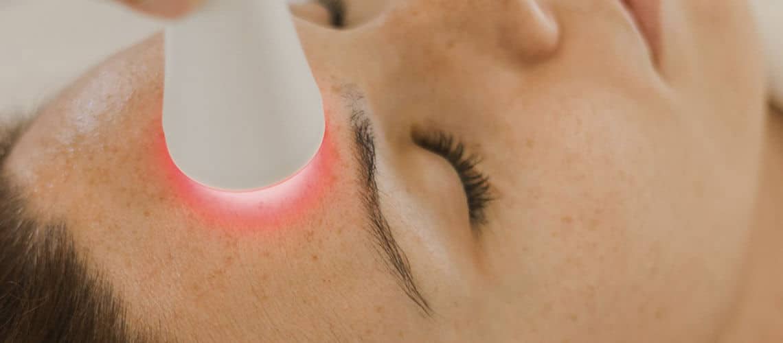 Mesoterapia facial