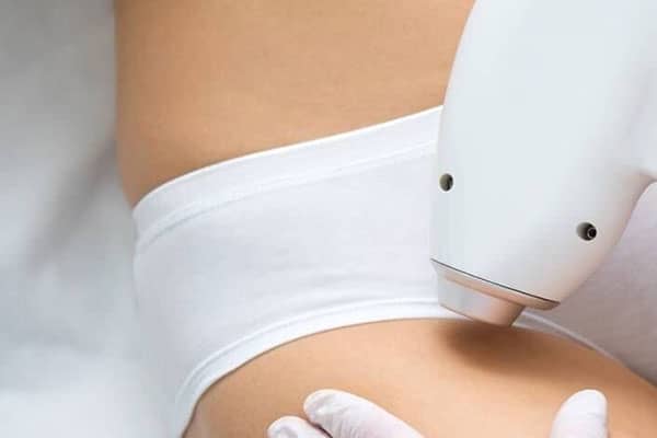 depilacion laser palma de mallorca