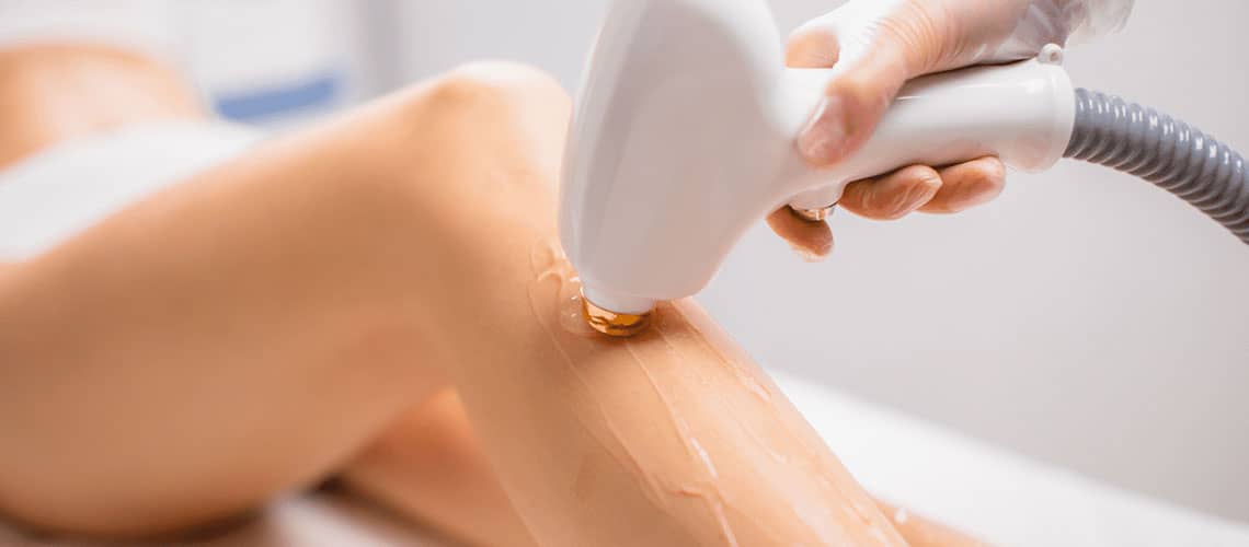 servicio depilacion laser palma de mallorca
